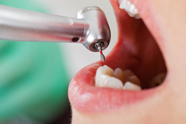 Best Broken or Cracked Tooth Emergency Dentist in Indian Harbour Beach, FL